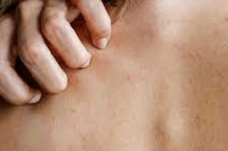Rajkot Update News this Symptom of Omicron appears only on the Skin